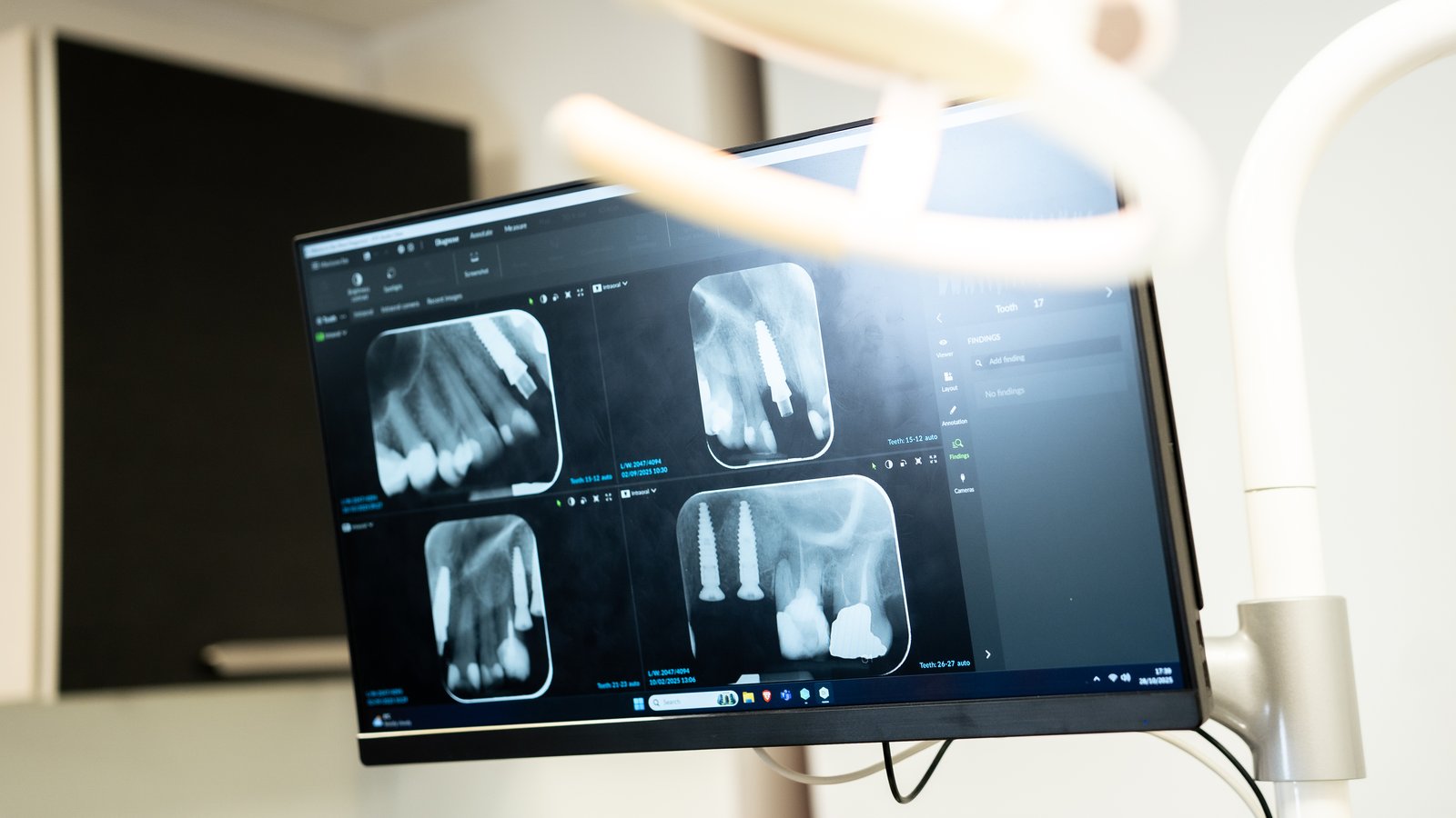 Zobārsts Villa Dental klīnikā Rīgā